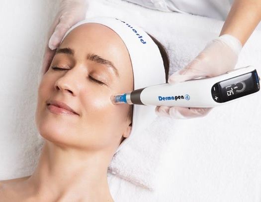 Dermapen μη Ενέσιμη Μεσοθεραπεία